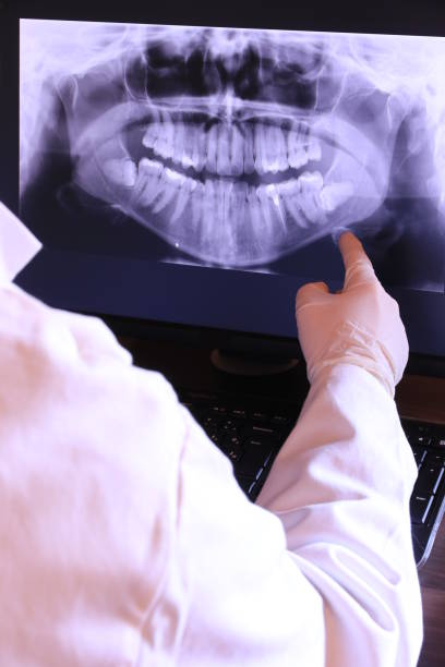 Best Emergency Broken Tooth Repair in Marcellus, MI