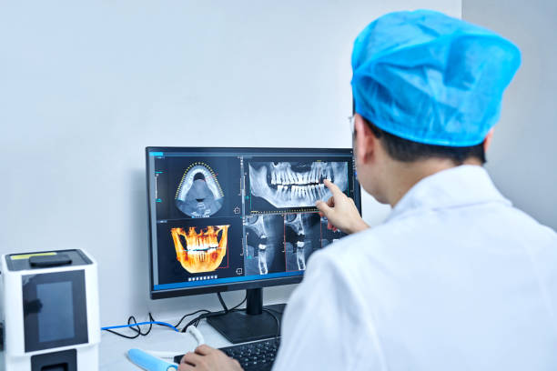 Best Emergency Root Canal Treatment in Marcellus, MI