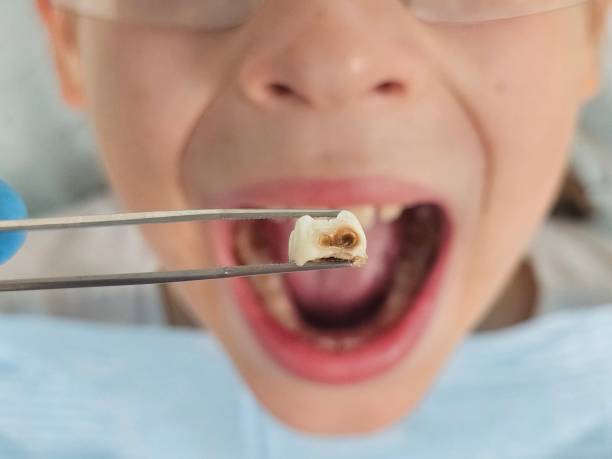 Best After-Hours Emergency Dentist in Marcellus, MI