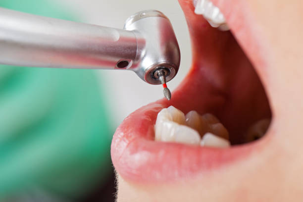 Best Pediatric Emergency Dentist in Marcellus, MI